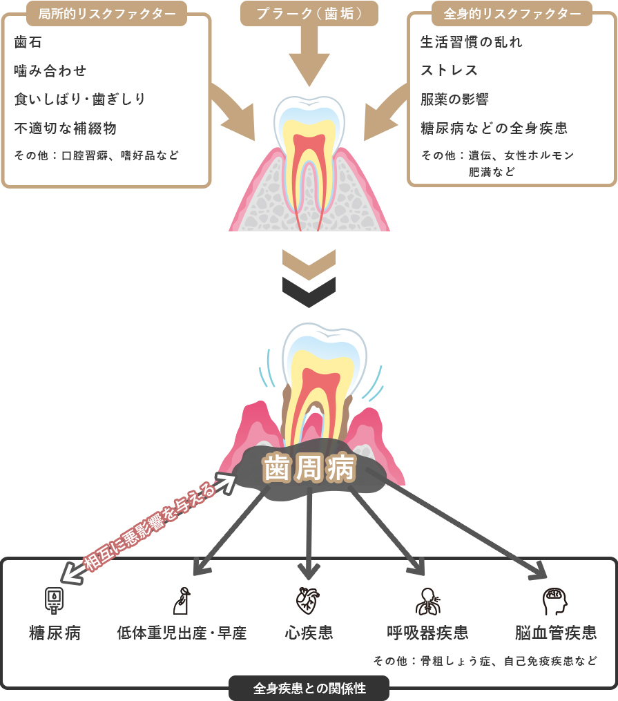 歯周病のリスクファクターに関する図解イラスト